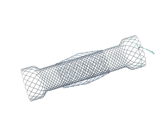 Niti-S Esophageal  Covered Stent [Double-Type]