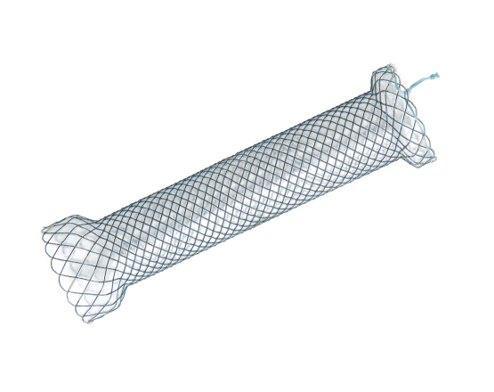 Niti-S Esophageal  Covered Stent [Cervical]