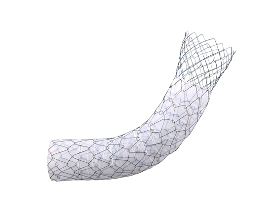 ComVi Pyloric/Duodenal Stent [Flare-Type]