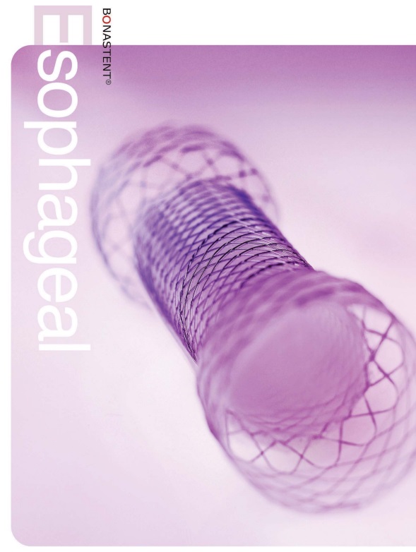 Bonastent Esophageal Shim Anti-Reflux Valve