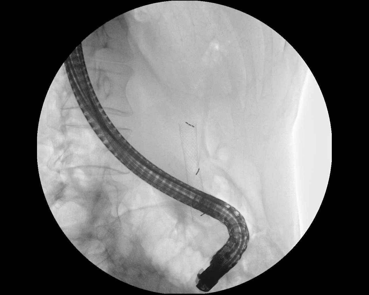 Nitinella Plus / Nitinella Plus - B