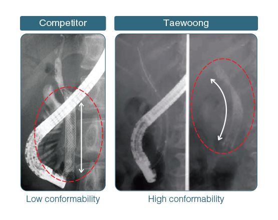 Niti-S Biliary Uncovered Stent [D-Type]